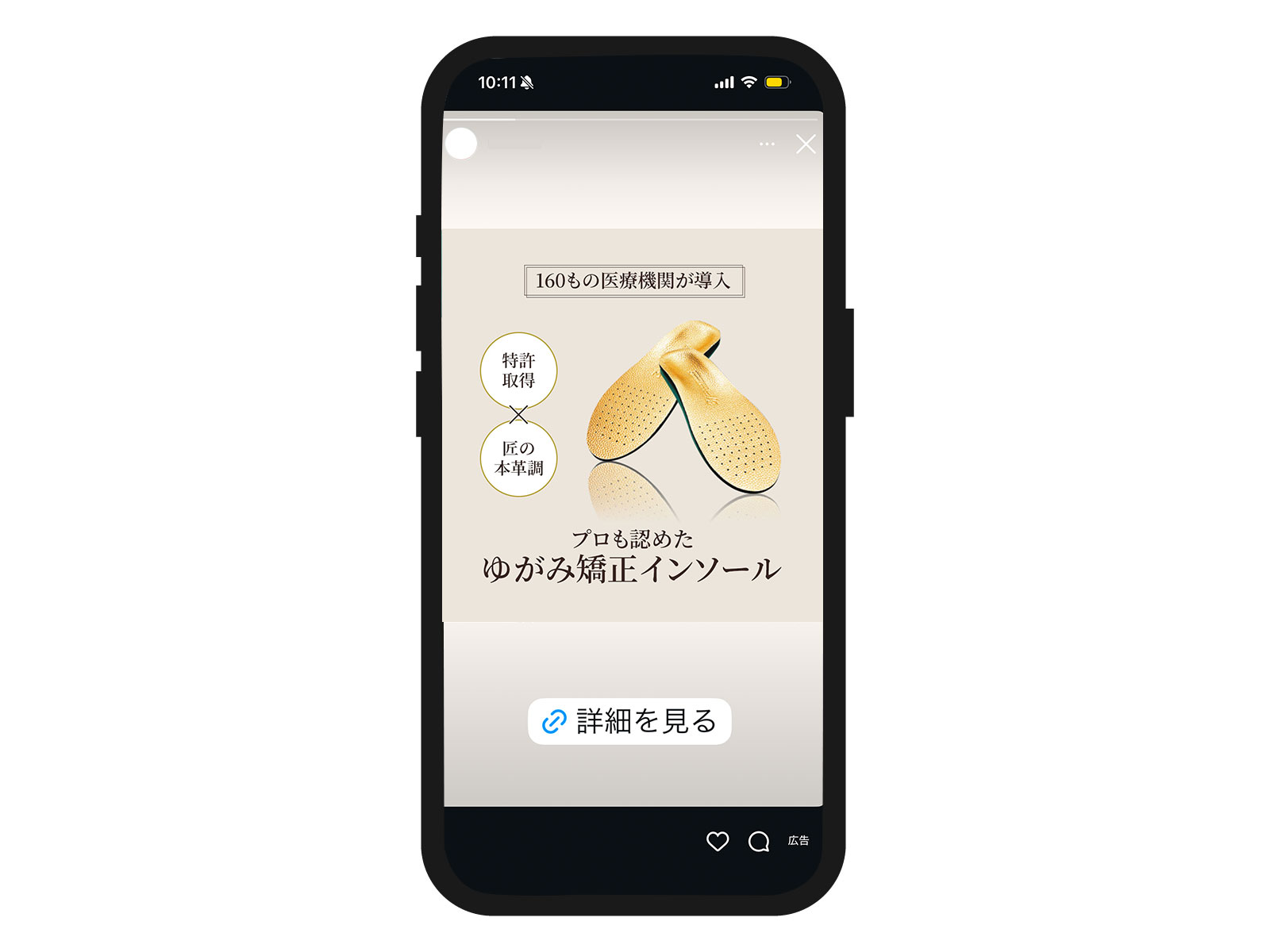 インソール制作実績